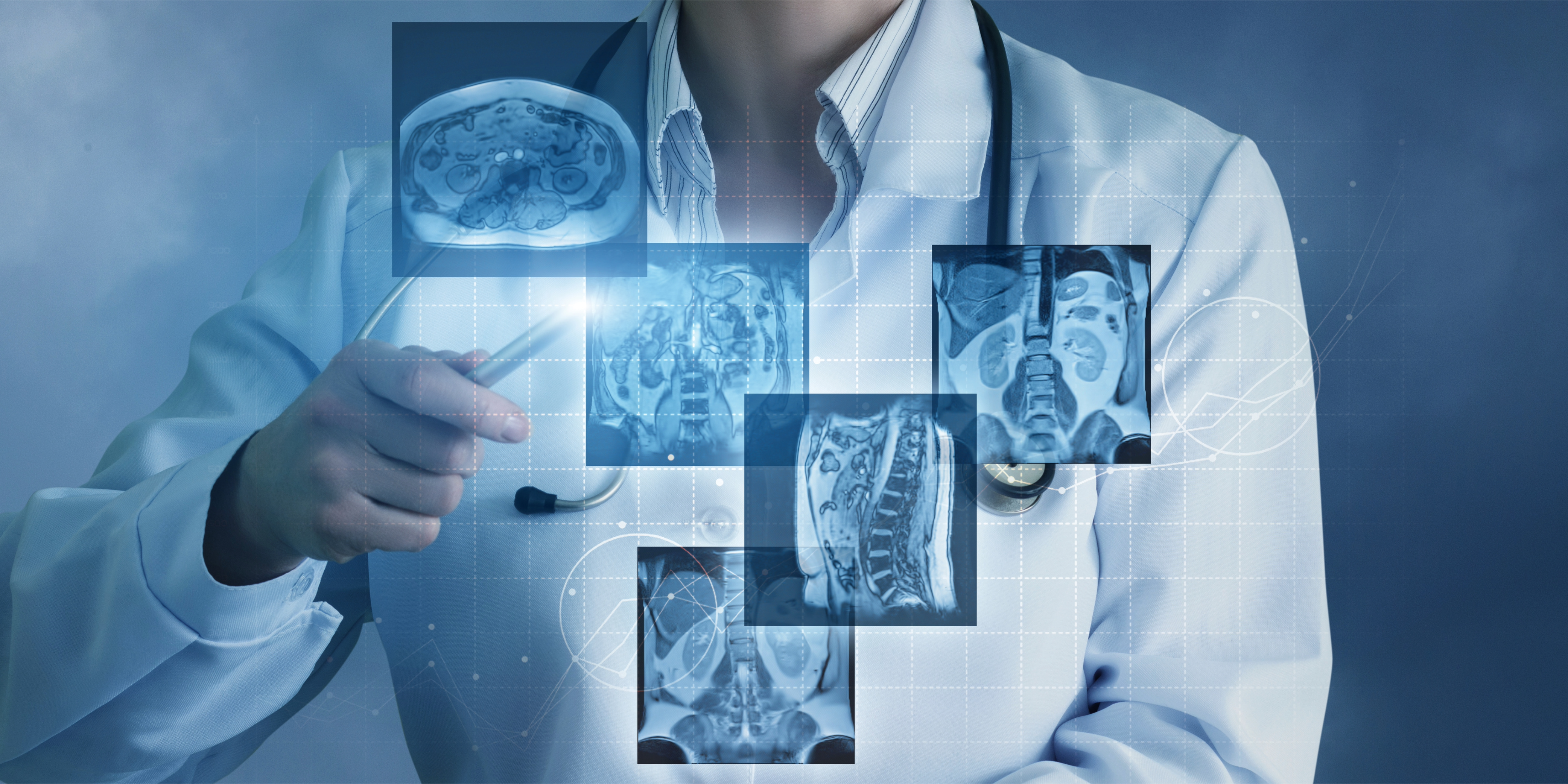Photo of a doctor and cancer imaging